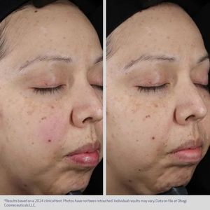 Hovedbilde Moisture Restore Hydration Replenishing Cream