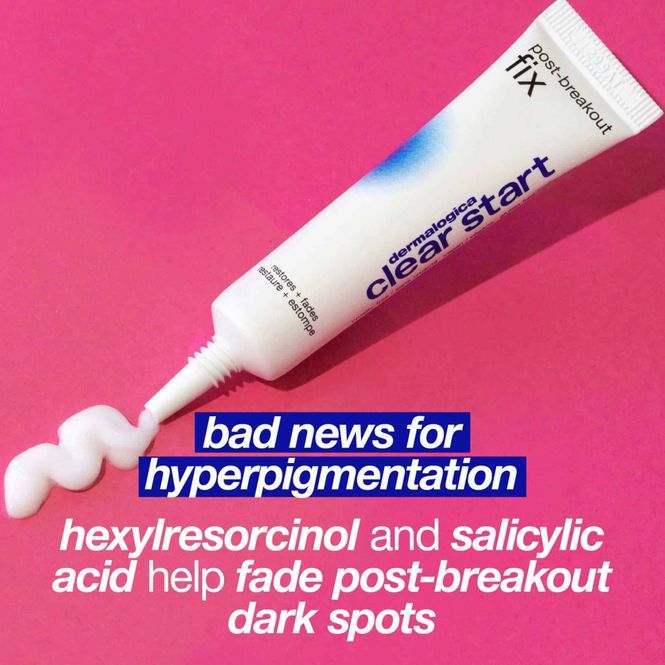 Hovedbilde post-breakout fix