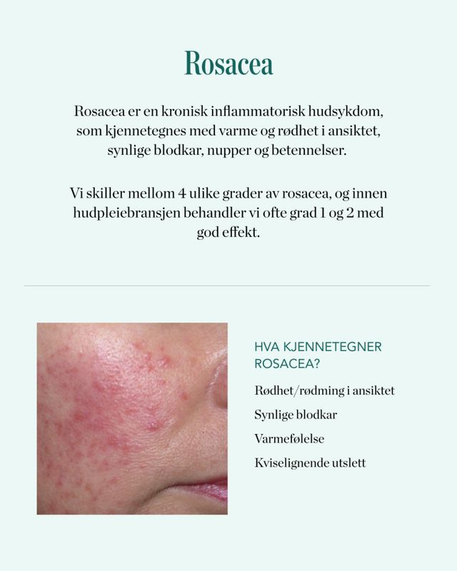 SOS paste