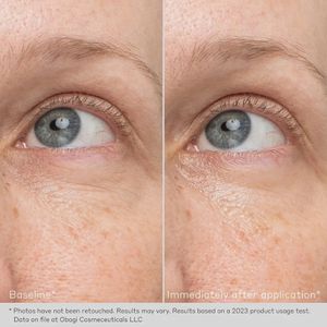 Hovedbilde REJUVENATING EYE GEL CREAM