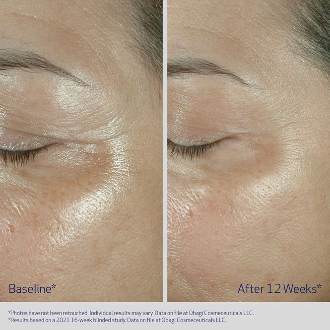 Hovedbilde ELASTIDERM EYE CREAM